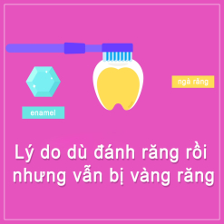 Lý do dù đánh răng rồi nhưng vẫn bị vàng răng